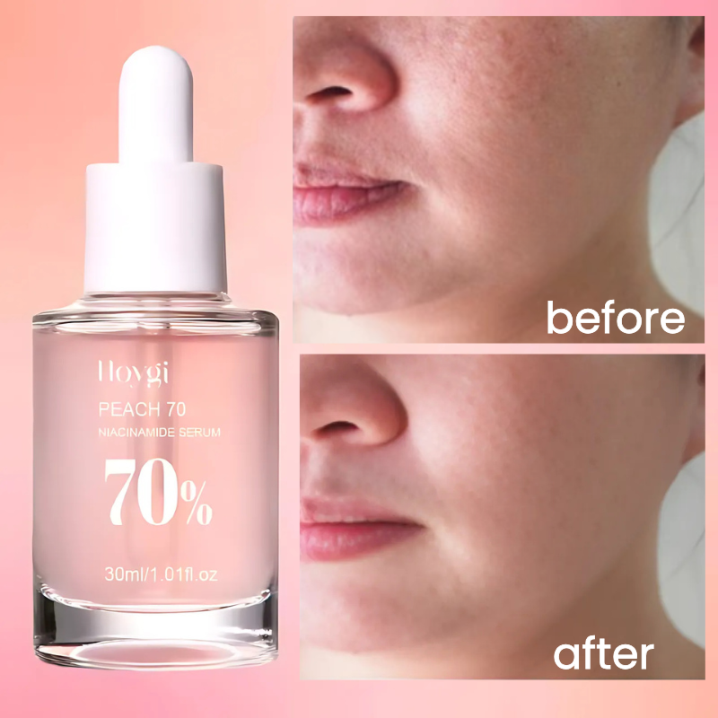 HOYGI - Suero iluminador con niacinamida al 70%