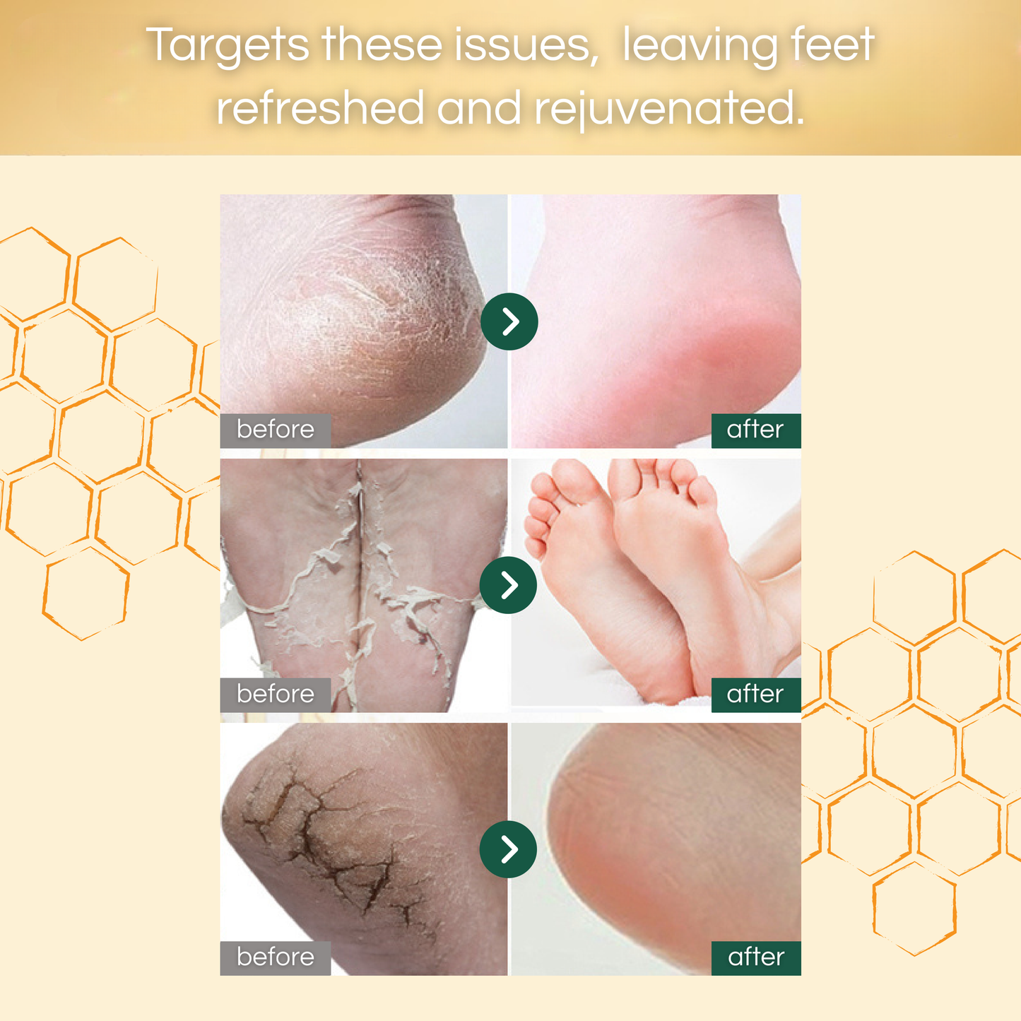 BIOAQUA - Honey & Vitamin E Foot Mask