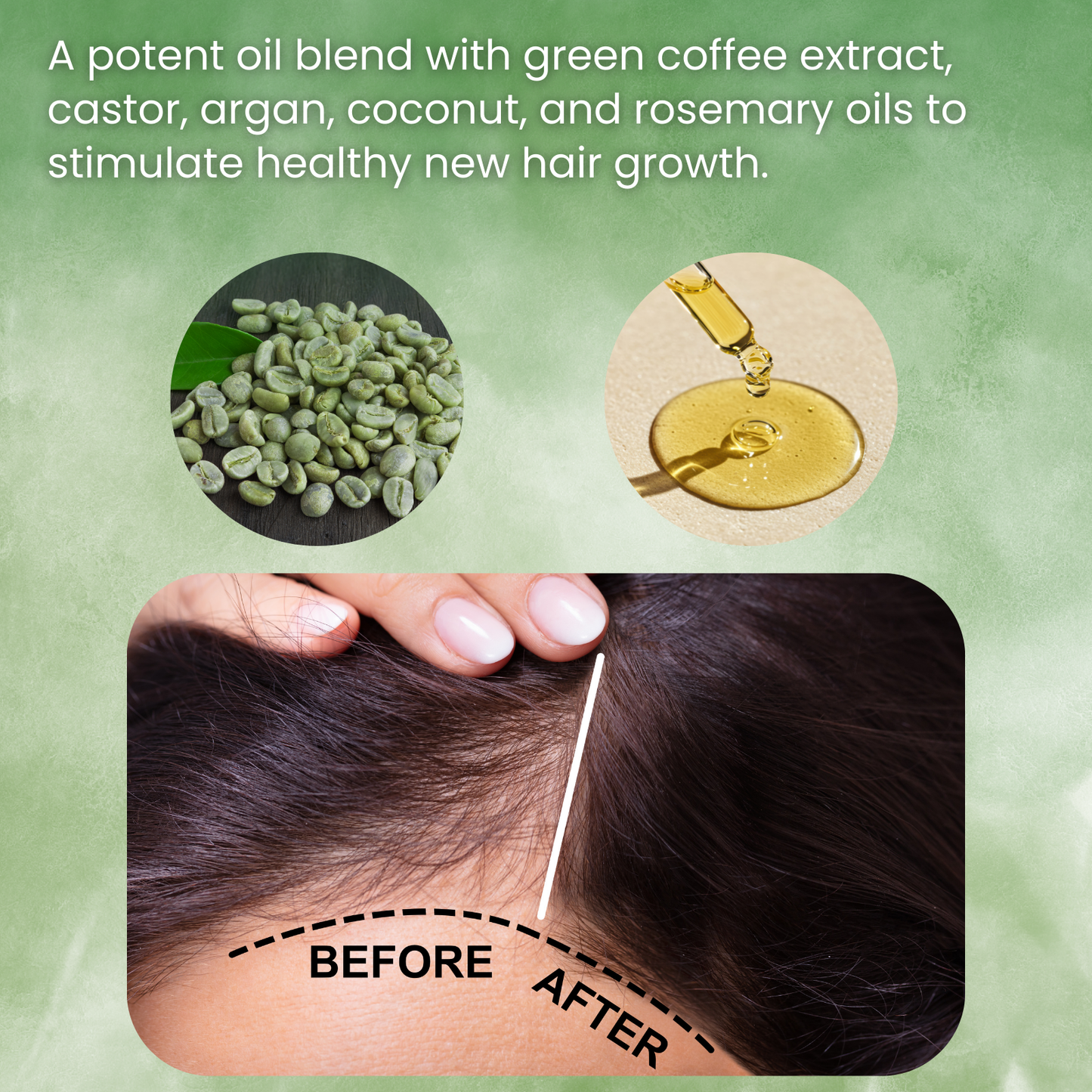 EELHOE - Hair Growth & Strengthening Oil Treatment