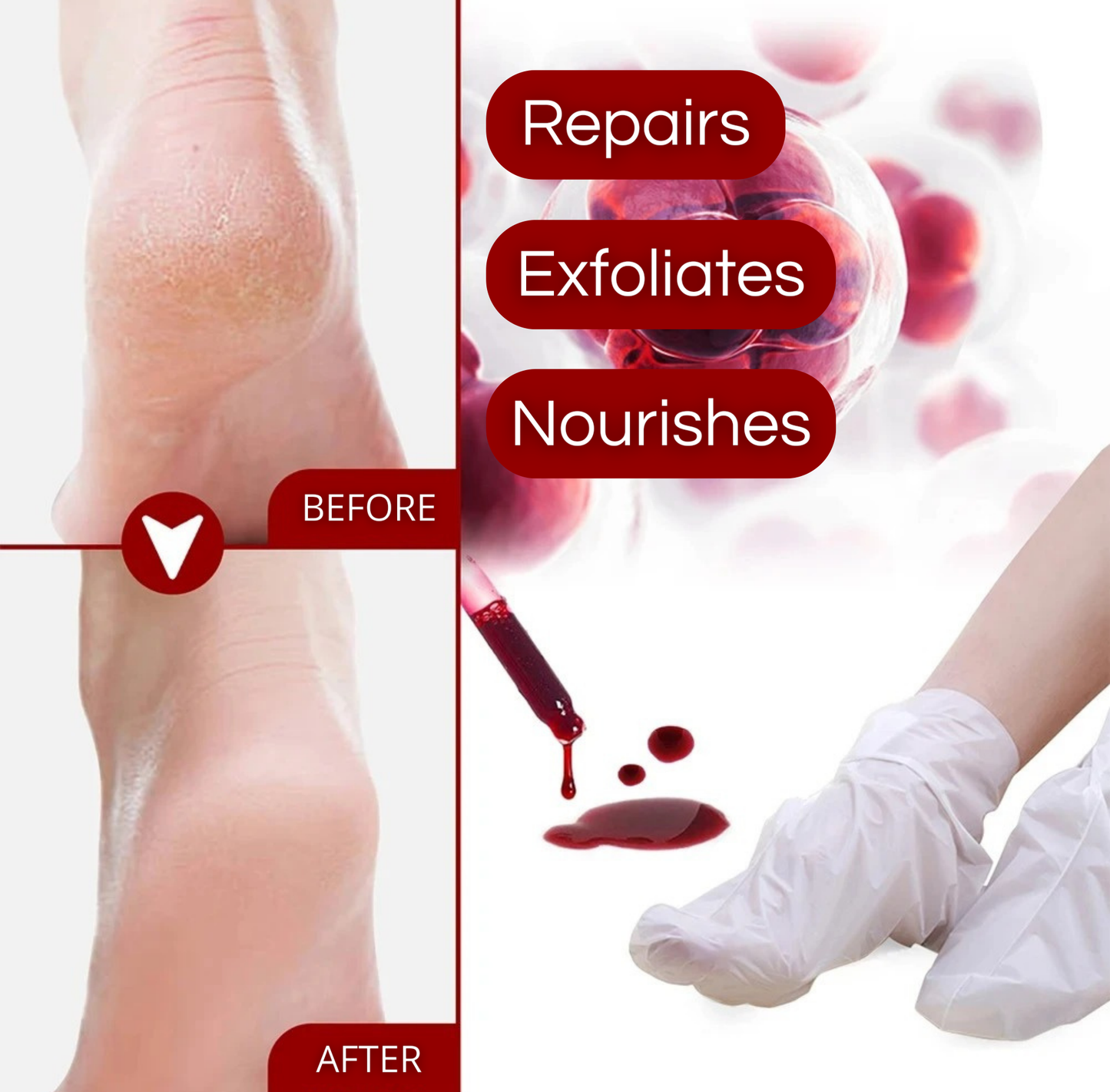 JAYSUING - AHA 30% Exfoliating Foot Mask